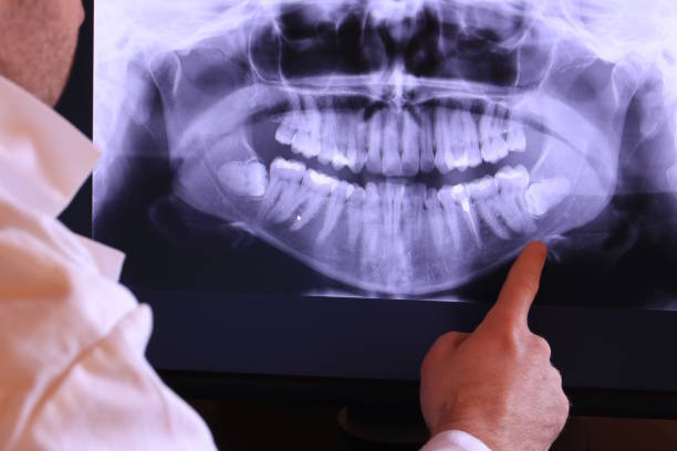 Best Emergency Dental Care for Broken or Chipped Teeth in Brady, TX